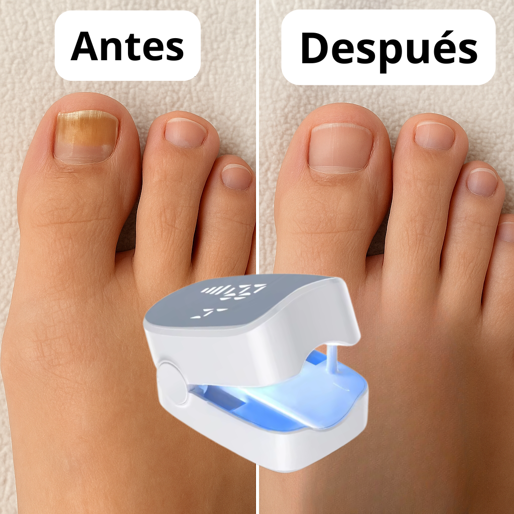 Láser LED para cuid-ad o de uñas - Adiós al miedo por mostrar las uñas