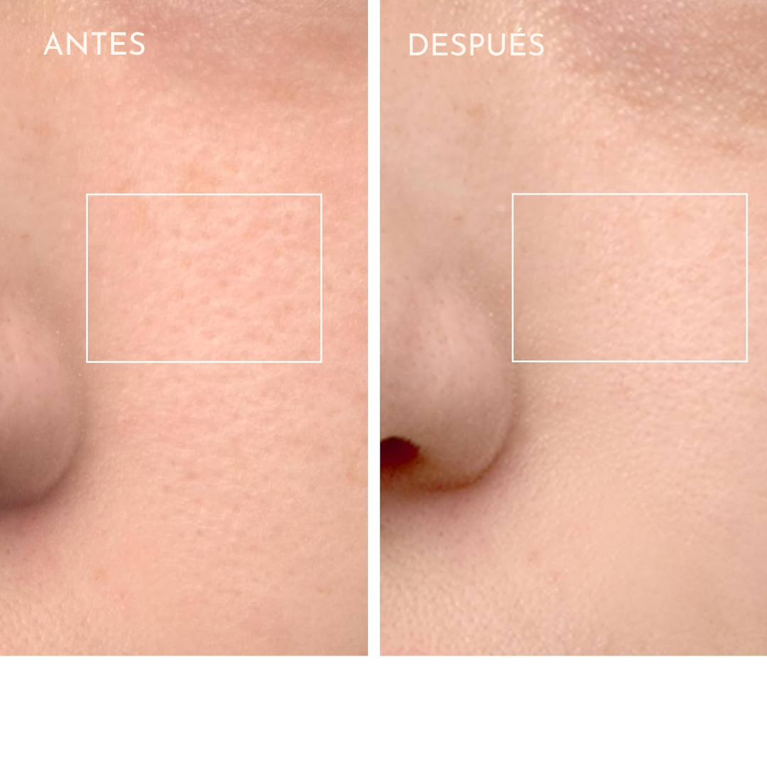 Limpiador Facial Exfoliante
